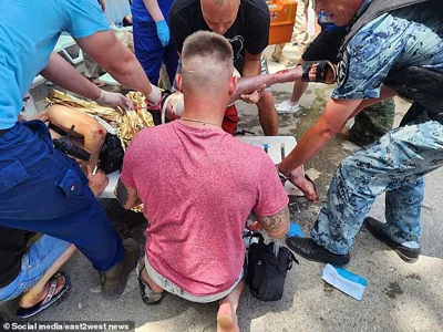 People gather round a Russian tourist who was wounded by the downed Ukrainian missile in Crimea on Sunday