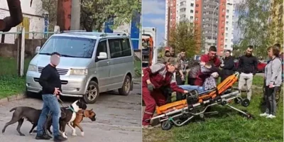 В Минске бойцовские собаки напали на парня с инвалидностью, люди еле его спасли