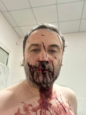Экс-депутат Госдумы Илья Пономарев* пострадал при взрыве БПЛА под Киевом