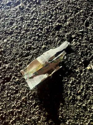 После взрыва 10-рублевой купюры в Красногорске мальчику ампутировали пальцы