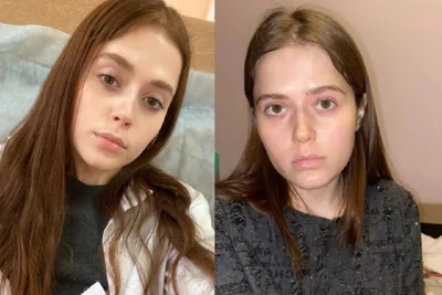 В Новосибирске умерла 23-летняя Татьяна Дроздова с редким генетическим заболеванием АДА-ТКИН, которая судилась с областным Минздравом за импортное лекарство стоимостью 50 миллионов рублей — мать девушки Алена Дроздова/«Комсомольская правда»