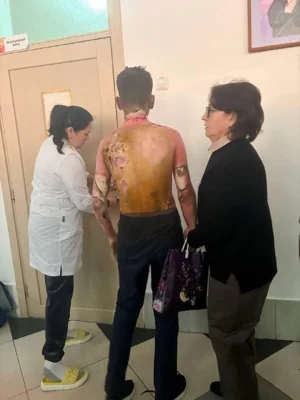 Школьница подожгла и избила молотком одноклассников в Красноярске