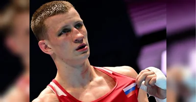 Чемпиону Европы по боксу выбили глаз в Крыму (фото, видео)