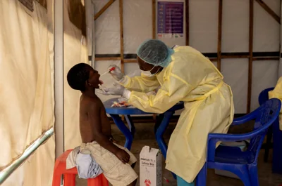 A laboratory nurse takes a sample from a child declared a suspected mpox case