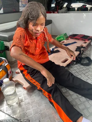 The rescued children (like the girl pictured above) suffered burn injuries